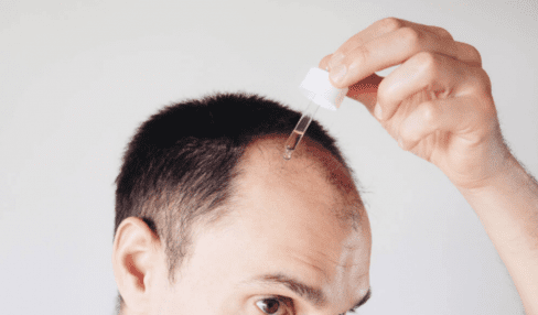 Best hair vitamins for hair growth